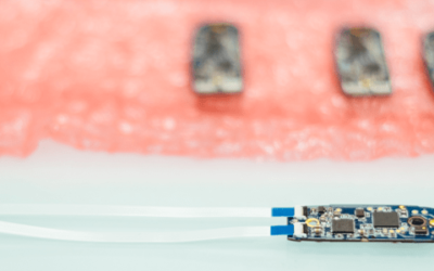 Orosound was Awarded at the INNOV’up Proto 2016 Contest